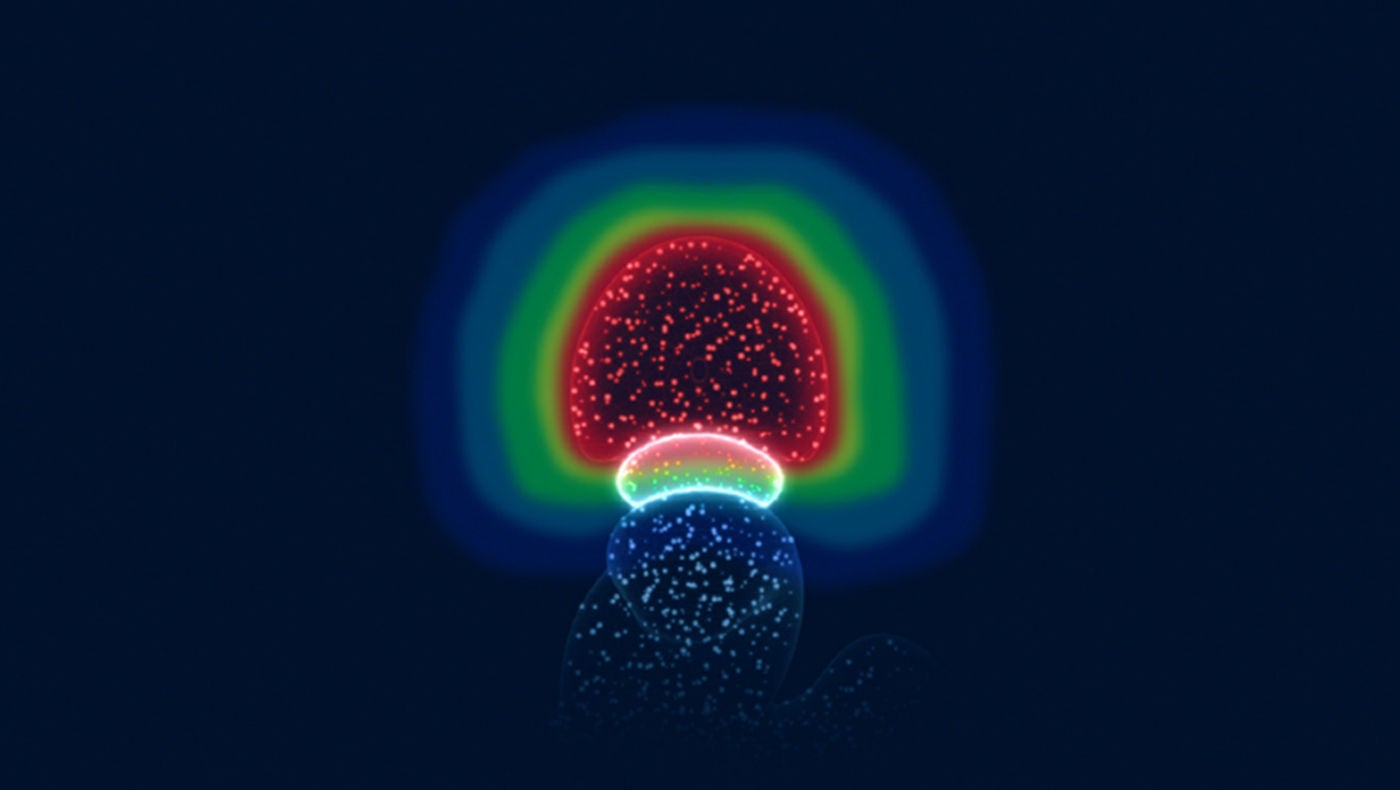 Visuelle Darstellung von SpaceOAR Hydrogel-Spacer