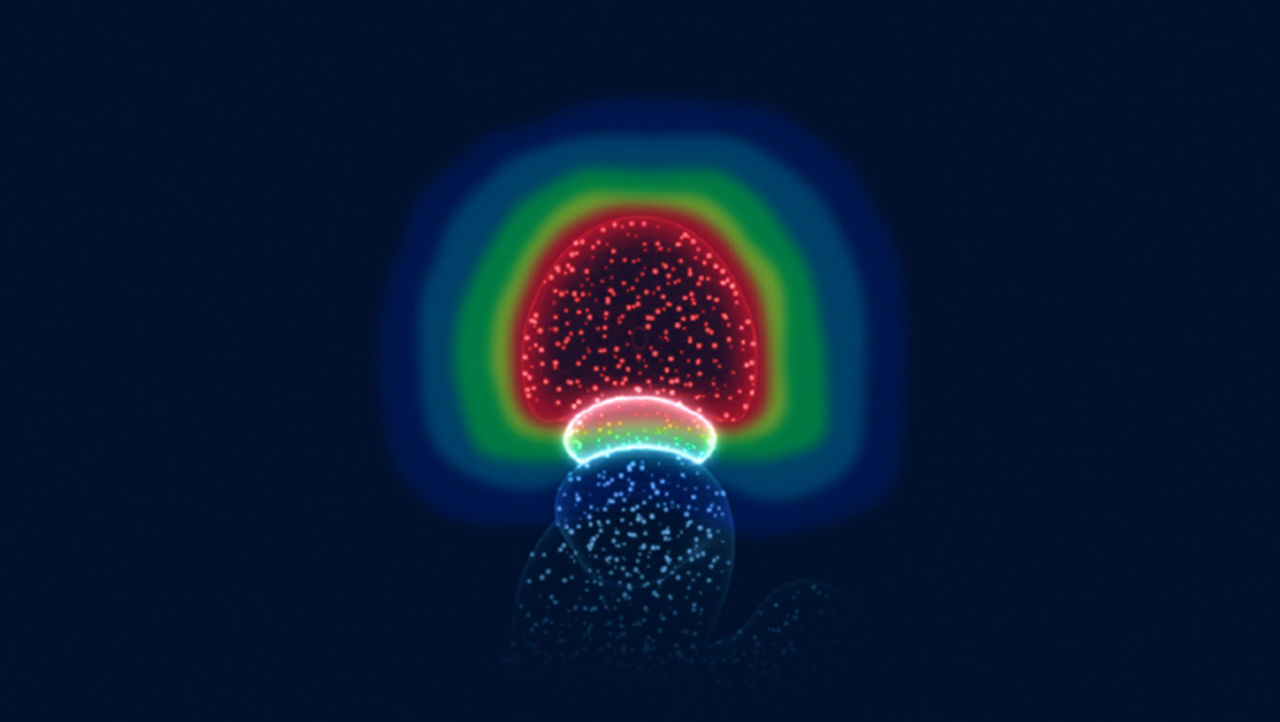 Visuelle Darstellung von SpaceOAR Hydrogel-Spacer